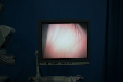 Surgical microscope 8