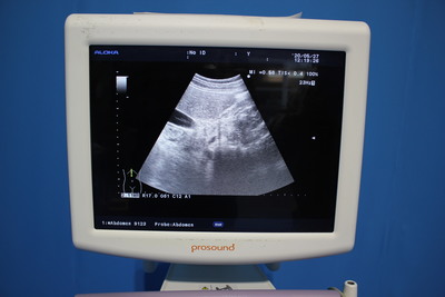 The ultrasonic diagnostic apparatus 8