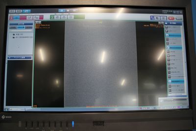 Computed Radiograph 8