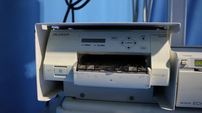 The ultrasonic diagnostic apparatus 8