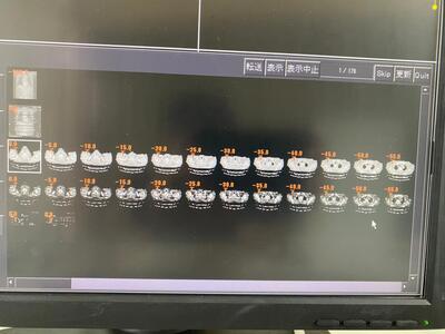 Multislice Computerized Tomography System 8