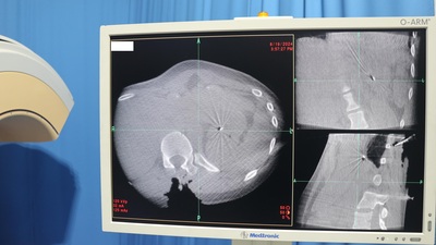 O-Arm Operation Imaging System 8