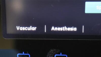 Ultrasound Diagnostic System 8