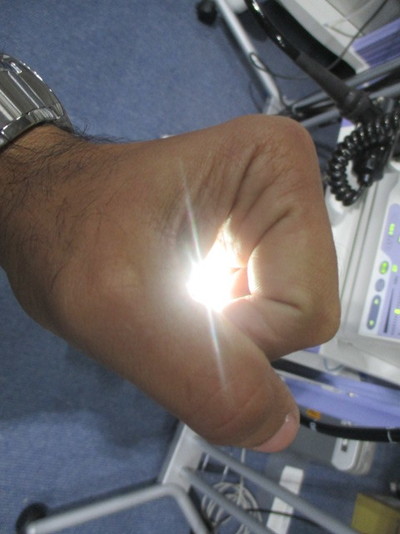 Colon videoscope 9
