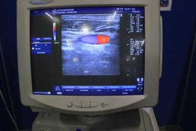 The ultrasonic diagnostic apparatus 9