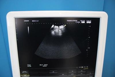 The ultrasonic diagnostic apparatus 9