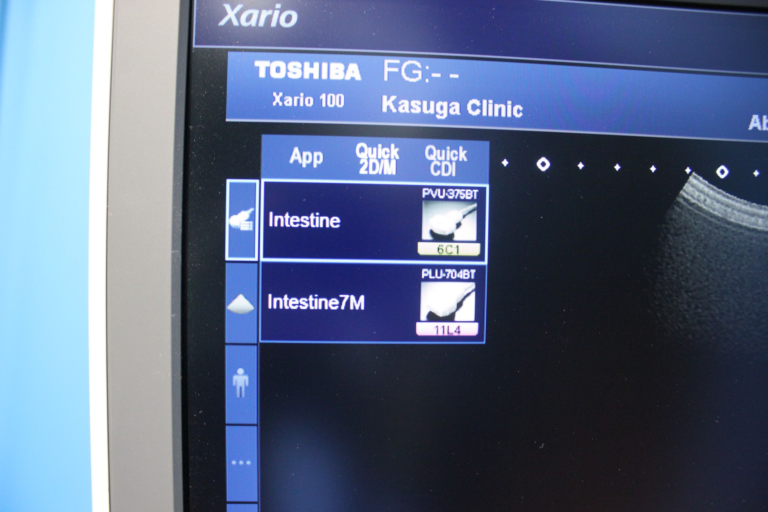 商品詳細 キャノンメディカルシステムズ株式会社 超音波診断装置 中古医療機器の買取り 販売 廃棄の専門 フェアーメディカル