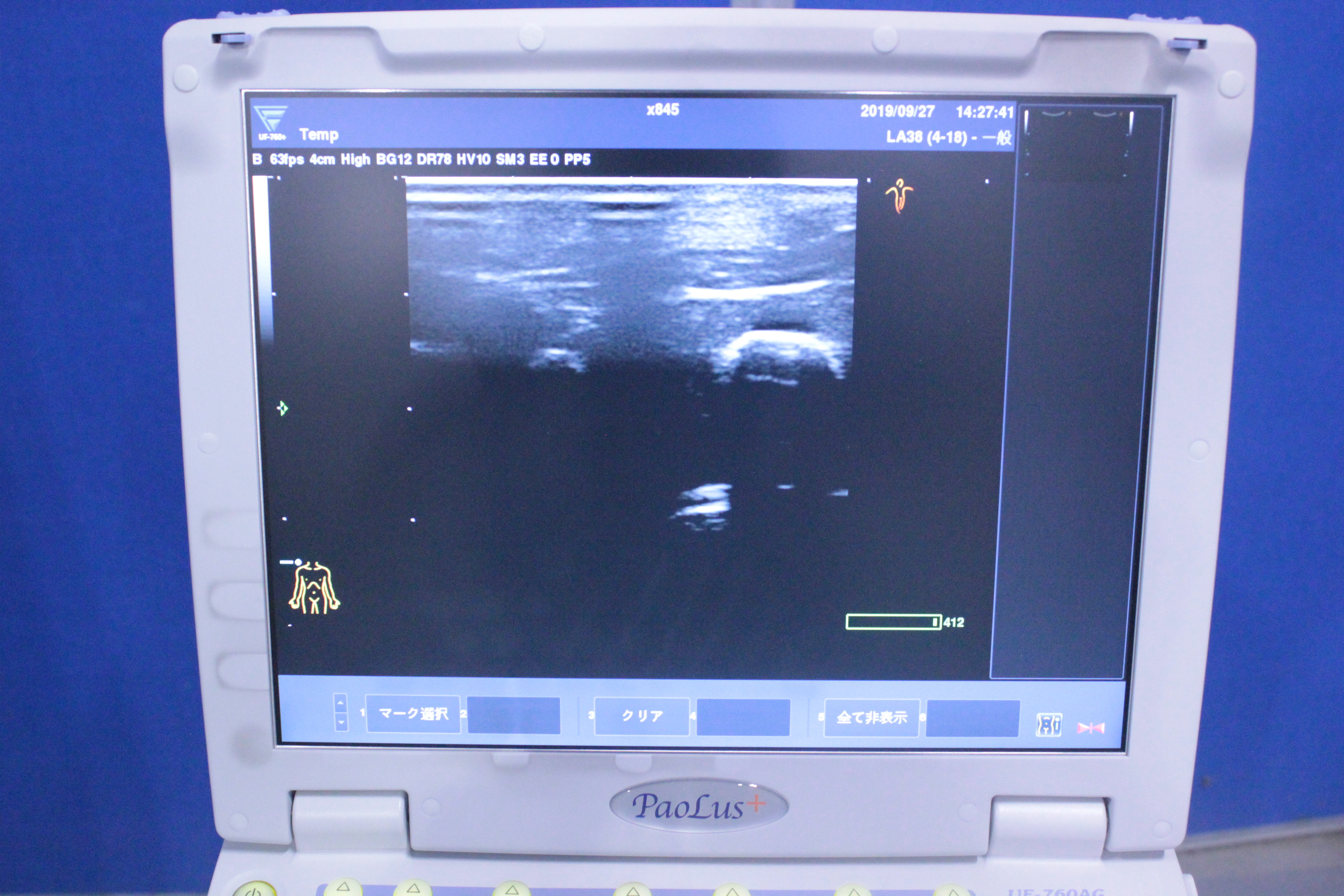 Product detail｜11119｜FUKUDA DENSHI｜Not Found｜UF-760AG+｜Fair